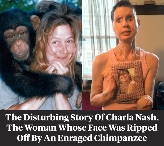 The sad story of Charla Nash, the woman whose face was ripped off by an chimpanzee