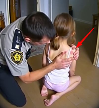 My 7-year-old came back from her mom’s place with marks. Her stepdad called it ‘toughening