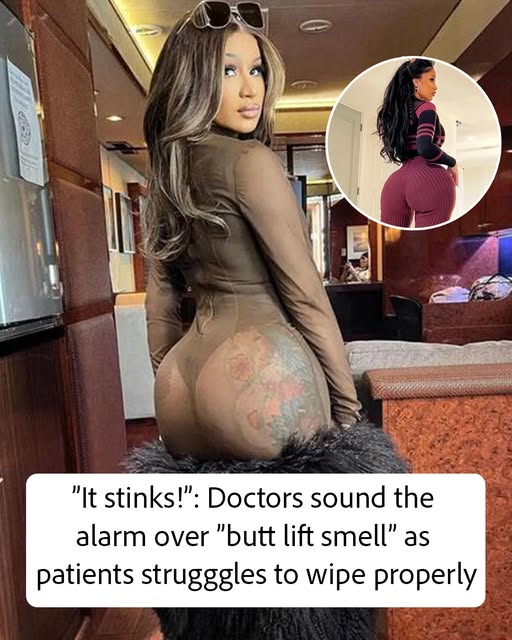 Doctors warn butt lift side effect may leave awful odor