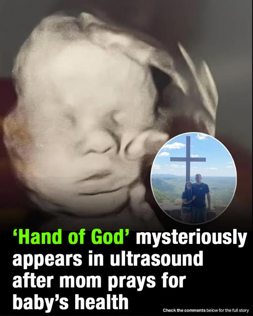 Mom spots ‘God’s hand’ cradling baby’s head in ultrasound
