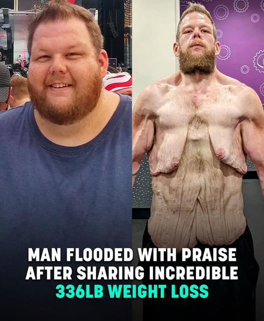Internet praises man for 360lb weight loss